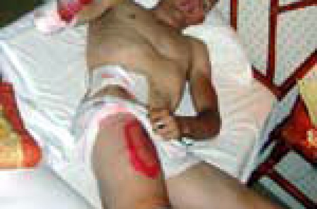Auch! When it hurts, it really hurts!
