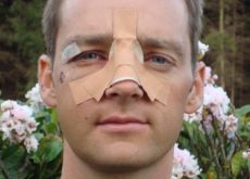 Photo of Team BMC Racing's Karsten Kroon after his surgery. Photo of Team BMC Racing's Karsten Kroon after his surgery.